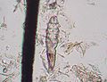 Demodex Mange mite